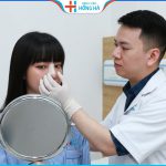Nâng mũi và thu gọn cánh mũi phẫu thuật cùng lúc có được không?