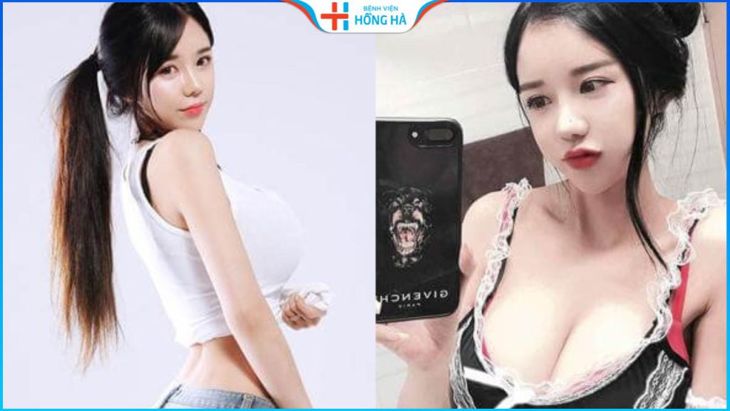 Nâng ngực ở đâu tốt nhất Hà Nội? Review từ khách hàng