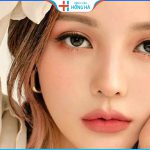 Nhấn mí được bao lâu? Cách duy trì đôi mắt đẹp sau nhấn mí