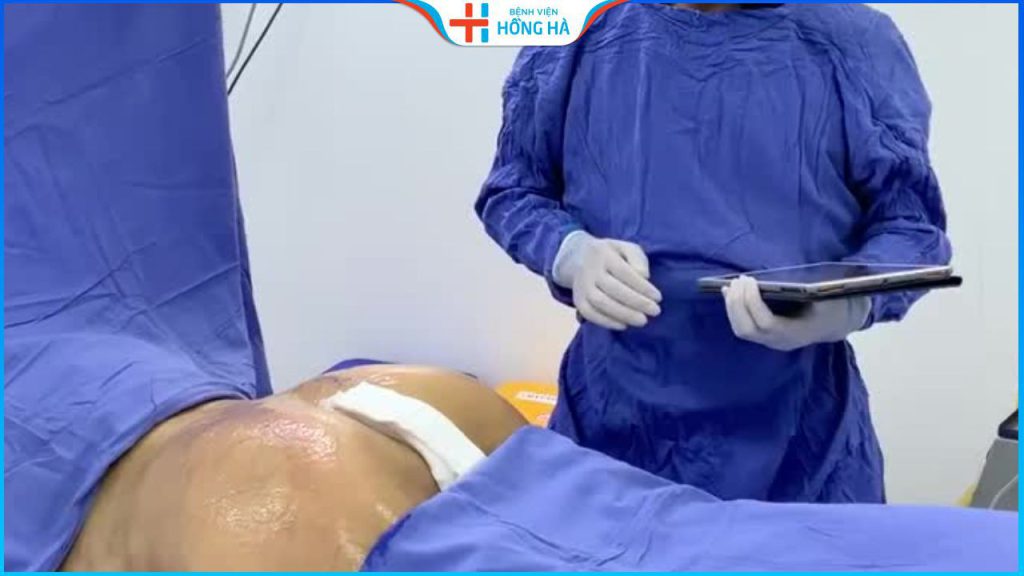 Tháo túi độn mông: Những điều cần biết sau khi tháo túi độn mông