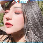 Thu nhỏ cánh mũi bao lâu thì lành, có để lại sẹo không?