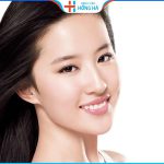 Thu nhỏ cánh mũi có để lại sẹo không| BV Hồng Hà làm rõ