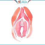 Thu nhỏ môi bé không cần phẫu thuật, giải pháp trẻ hóa toàn diện vùng kín