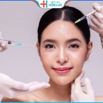 Tiêm botox gọn hàm giữ được bao lâu? Địa chỉ tiêm botox uy tín