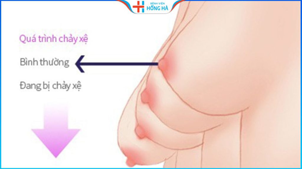 Treo vòng 1 sa trễ giá bao nhiêu? Treo ngực ở đâu đẹp, giá tốt