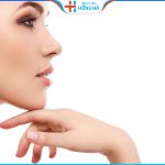 Phẫu thuật gọt hàm có xảy ra biến chứng không? Bao lâu thì đẹp?