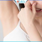 Địa chỉ cắt tuyến mồ hôi nách ở TPHCM? Tiêu chí chọn địa chỉ uy tín?