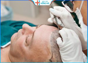 Cấy tóc tự thân có hiệu quả không? Các phương pháp phổ biến