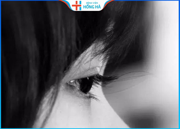 Đôi mắt buồn – Bí ẩn tướng số và ảnh hưởng trong cuộc sống