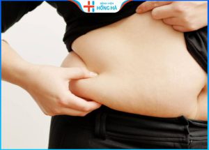 Bật Mí 10+ Cách giảm mỡ bụng dưới hiệu quả thần tốc