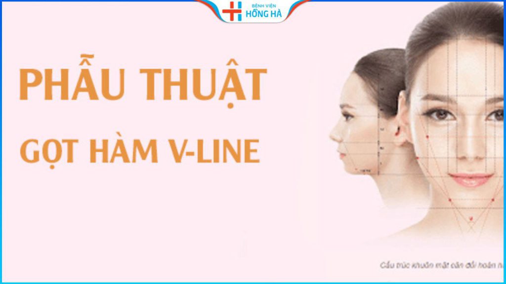 Gọt hàm giá bao nhiêu? 4 yếu tố ảnh hưởng chi phí gọt hàm