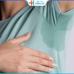 Hút nội soi tuyến mồ hôi nách: Loại bỏ mùi hôi sau 1 lần thực hiện