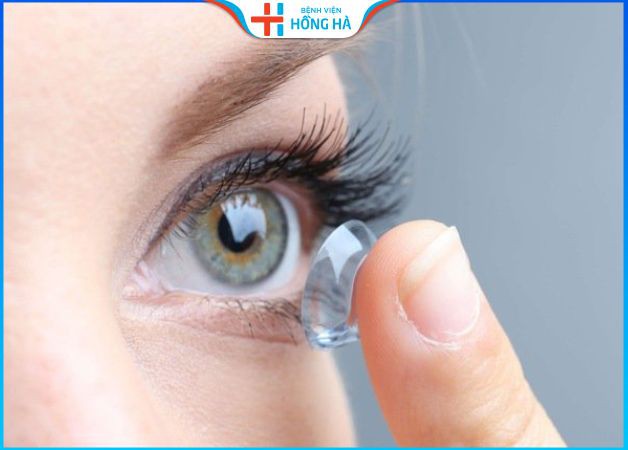 Sử dụng kính áp tròng cũng là cách khắc phục mắt dại