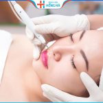 Tẩy nốt ruồi kiêng gì? 4 cách chăm sóc đúng để tránh sẹo