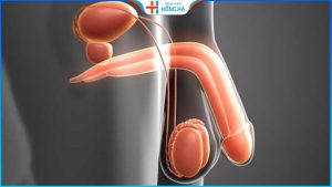 Tinh hoàn bị u: Triệu chứng, chẩn đoán và điều trị hiệu quả
