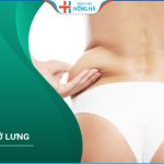 Hút mỡ lưng có đau không – 4 ưu điểm vượt trội hút mỡ lưng Vaser Lipo