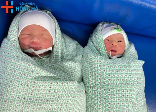 Hai em bé sinh đôi nhờ bơm tinh trùng IUI tại Hồng Hà