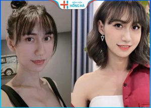 Cắt trái cổ có nguy hiểm không? Có để lại sẹo không