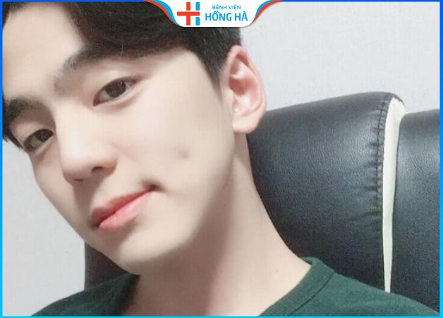 Đàn ông có 2 má lúm đồng tiền ý nghĩa, vận mệnh trong nhân tướng học