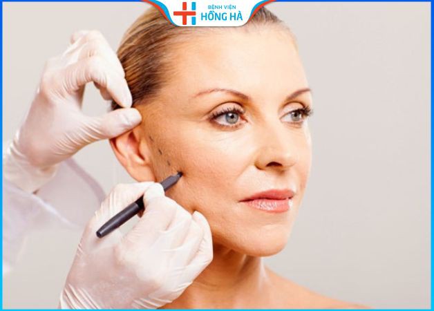 Quá trình phẫu thuật căng da mặt được tiến hành theo quy chuẩn của Bộ Y tế