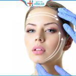 5 loại chỉ căng da mặt an toàn, thông dụng hiện nay