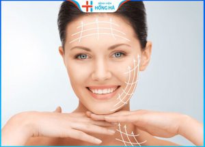 Căng chỉ da mặt bao lâu thì đẹp – 4 cách kéo dài hiệu quả căng da mặt