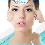 Căng da mặt bao lâu thì lành? Giải đáp từ bác sĩ thẩm mỹ