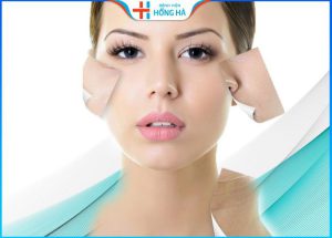 Căng da mặt bao lâu thì lành? Giải đáp từ bác sĩ thẩm mỹ