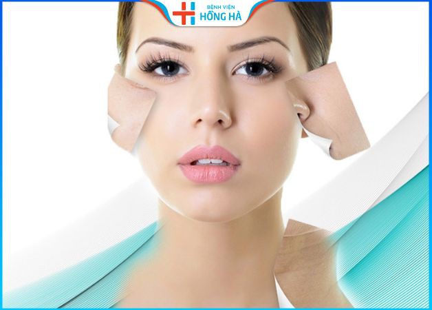 Căng da mặt bao lâu thì lành? Giải đáp từ bác sĩ thẩm mỹ