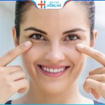 Cắt mí dưới có để lại sẹo không? 3 yếu tố gây sẹo xấu sau cắt mí dưới