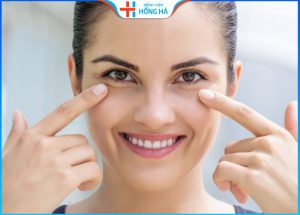 Cắt mí dưới có để lại sẹo không? 3 yếu tố gây sẹo xấu sau cắt mí dưới