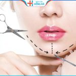 Giải đáp: Độn cằm mấy ngày hết sưng? Chăm sóc sau độn cằm?