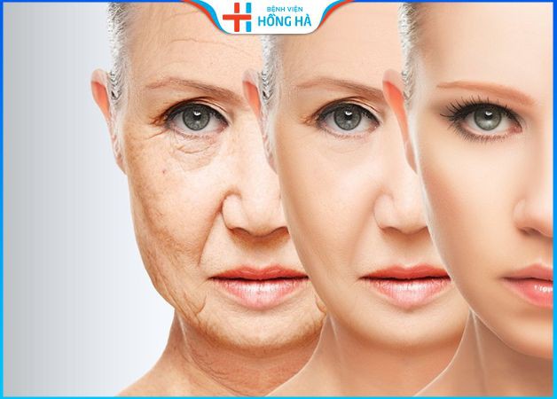 Kinh nghiệm căng da mặt giúp trẻ hóa toàn diện, an toàn tuyệt đối