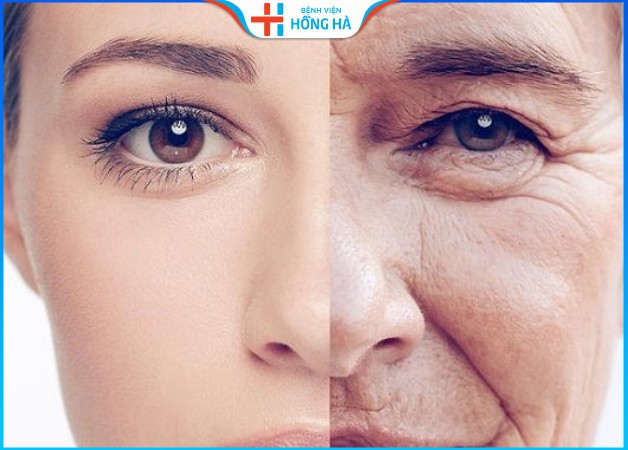Phẫu thuật căng da mặt nội soi – 90 Phút trẻ lại 10 năm tuổi