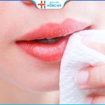 Sửa sẹo môi hết bao nhiêu tiền – 4 yếu tố ảnh hưởng tới chi phí