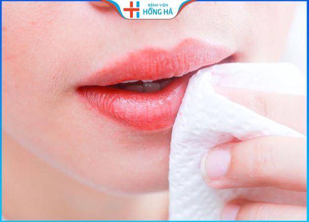 Sửa sẹo môi hết bao nhiêu tiền – 4 yếu tố ảnh hưởng tới chi phí