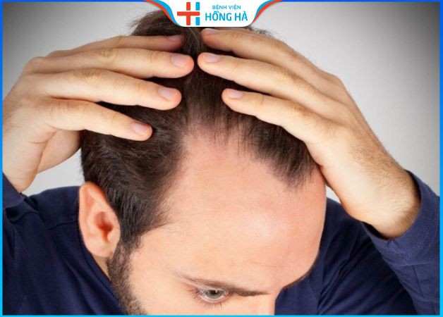 18 cách xem tướng trán và bí quyết thay đổi vận số