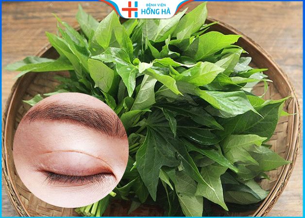 Cắt mí ăn rau lang được không – 6 thực phẩm kiêng ăn sau cắt mí