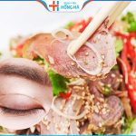 Cắt mí ăn thịt dê được không – Thực phẩm cần và kiêng ăn sau cắt mí