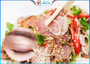 Cắt mí ăn thịt dê được không – Thực phẩm cần và kiêng ăn sau cắt mí
