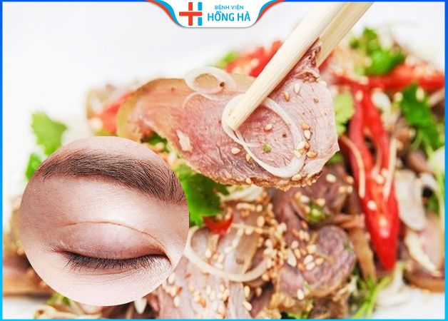 Cắt mí ăn thịt dê được không – Thực phẩm cần và kiêng ăn sau cắt mí
