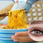 Cắt mí có được ăn mì tôm không – 4 Nguyên nhân và 3 hậu quả sau khi ăn