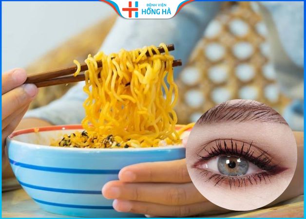 Cắt mí có được ăn mì tôm không – 4 Nguyên nhân và 3 hậu quả sau khi ăn