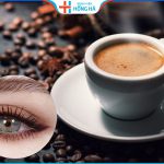 Cắt mí có được uống cà phê không – 2 loại nước không uống sau cắt mí