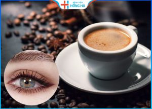 Cắt mí có được uống cà phê không – 2 loại nước không uống sau cắt mí