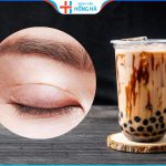 Cắt mí có được uống trà sữa không – 3 Lưu ý uống trà sữa sau cắt mí