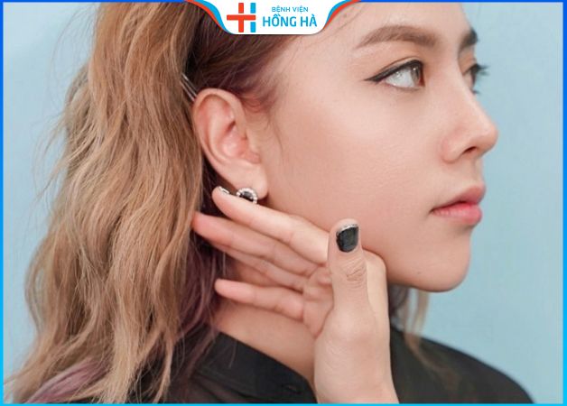 Độn cằm kiêng ăn bao lâu? Nên kiêng gì – Ăn gì lành vết thương 99%