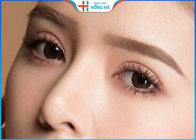 Chia sẻ kinh nghiệm đi cắt mí mắt từ Chuyên gia và Khách hàng