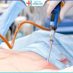 Kinh nghiệm sau hút mỡ bụng từ chuyên gia thẩm mỹ hàng đầu