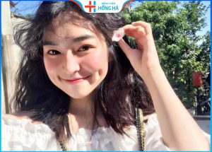 Sở hữu má lúm đồng tiền 1 bên chỉ sau 20 phút tại Hồng Hà